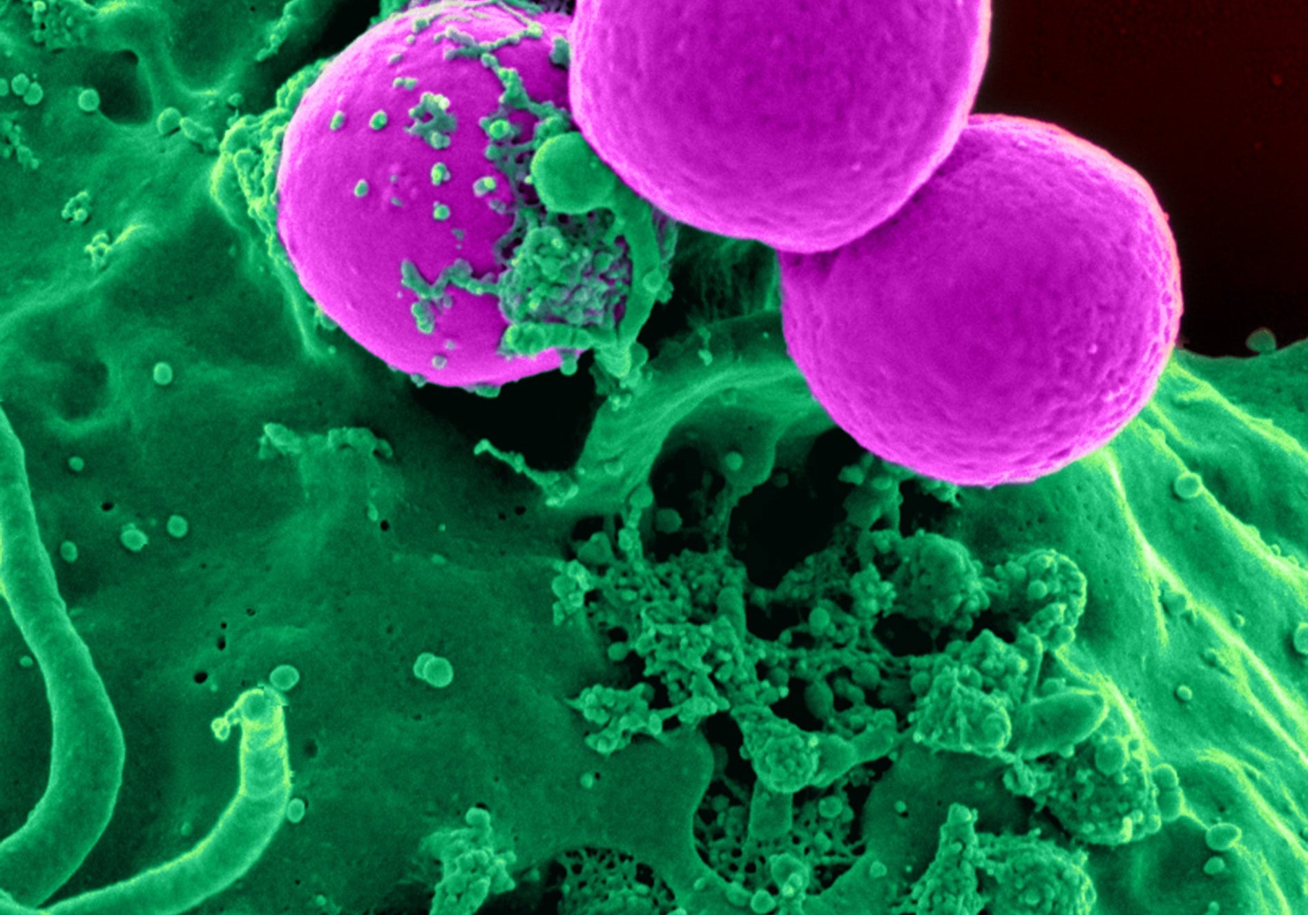 Mikronährstoffe in der Onkologie