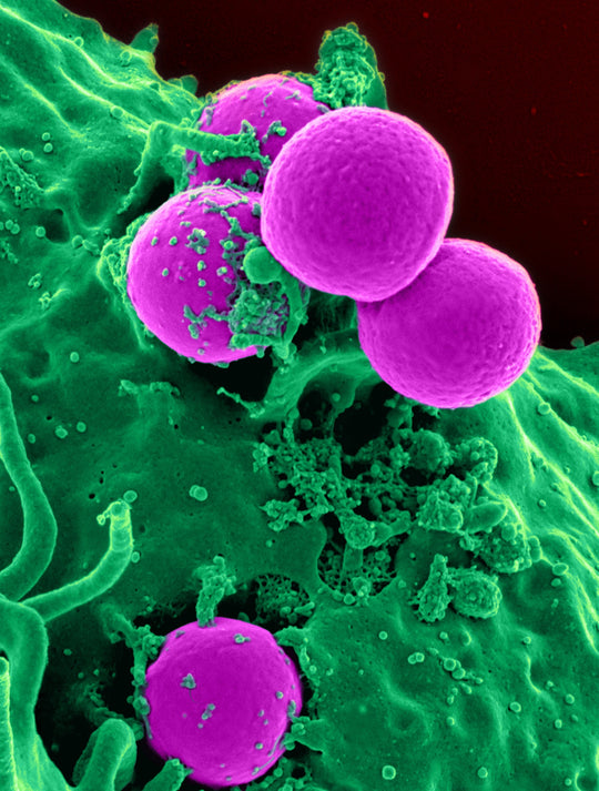Mikronährstoffe in der Onkologie